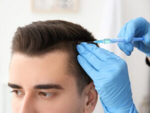 hair transplant