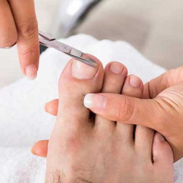 Ingrown Toe Nail Removal Treatment in Bangalore