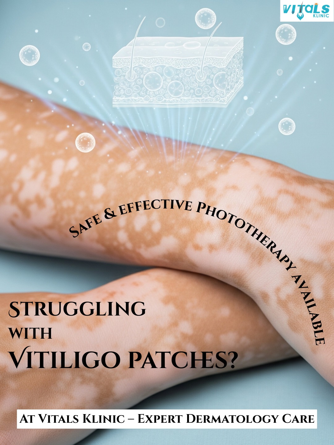 Best Scar Removal Treatment in Bangalore