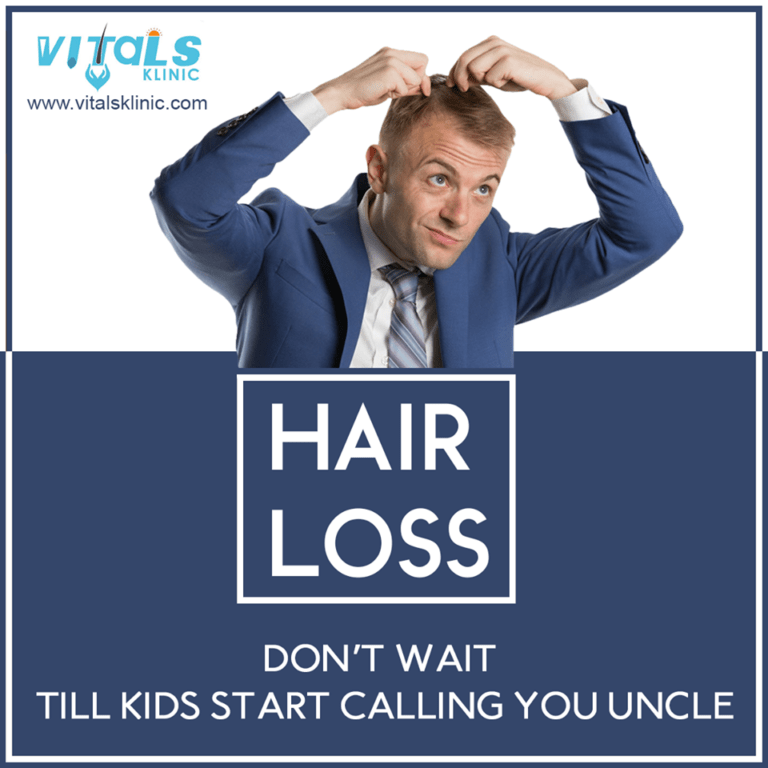 Best Hair Fall Treatment in Bangalore (2023) VitalsKlinic