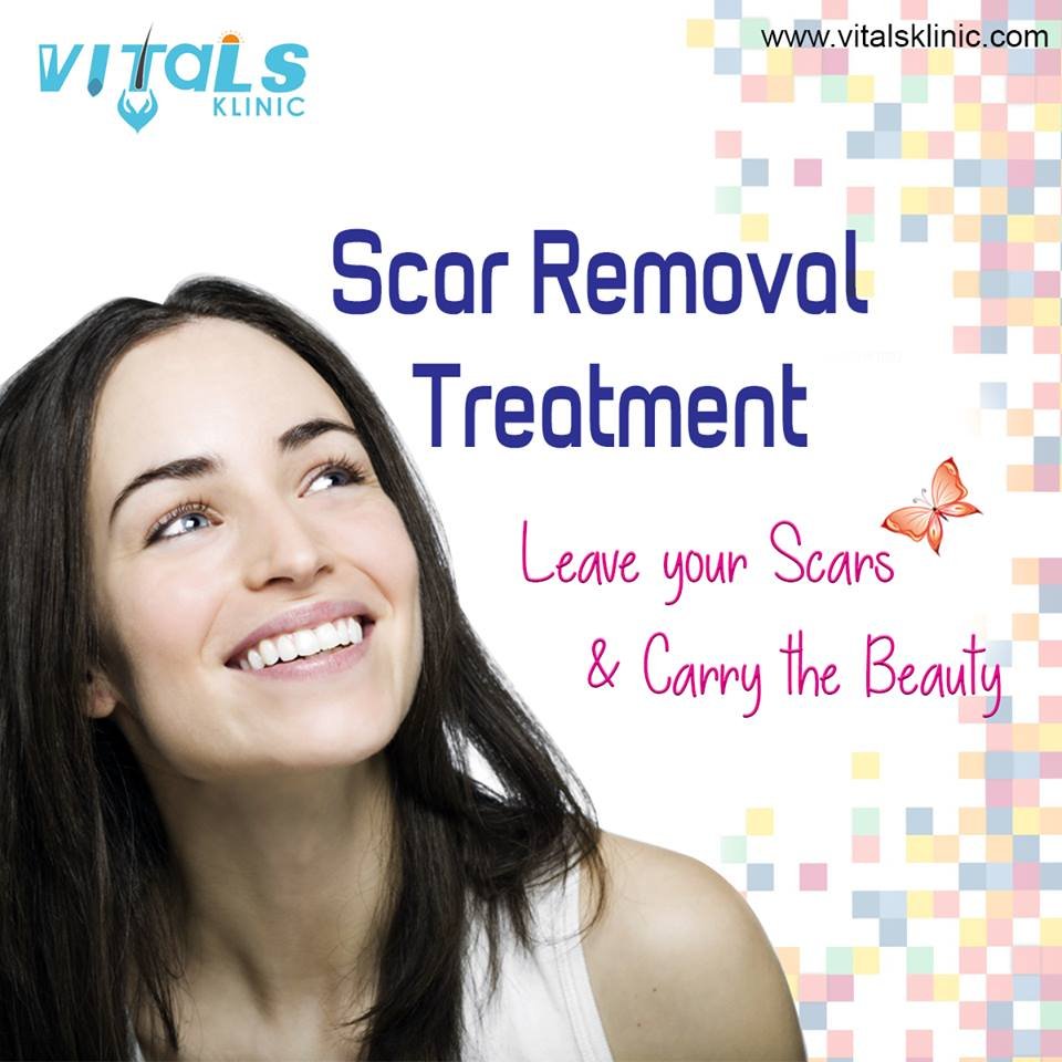 Best Scar Revision Surgery in Bangalore VitalsKlinic