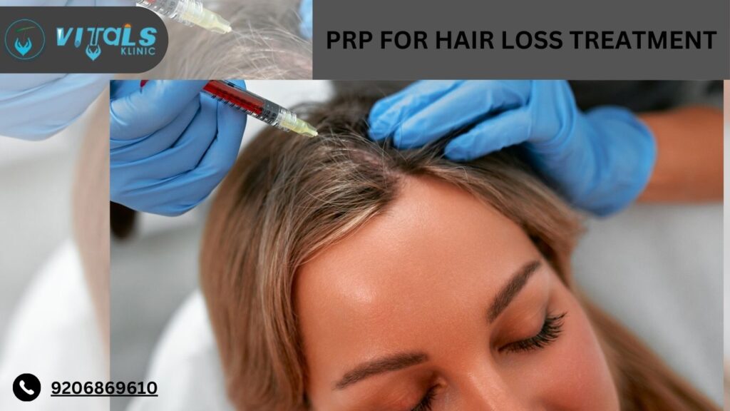 PRP Hair Loss Treatment in Bangalore – 2025