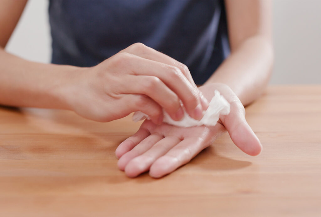 SWEATING PALMS (HYPERHIDROSIS) TREATMENT IN BANGALORE – 2025