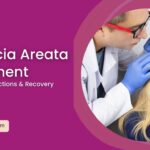 alopecia areata treatment