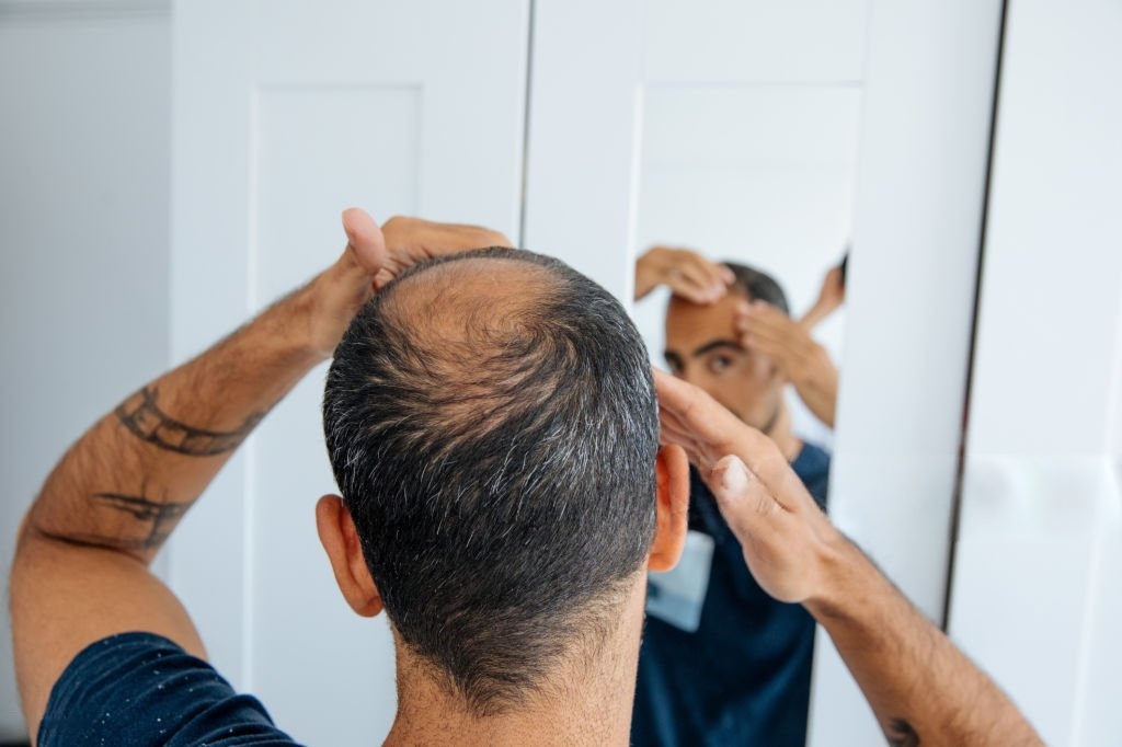 Regenera Activa Hair Loss Treatment Services in Bangalore
