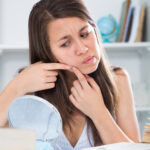 acne vs purging