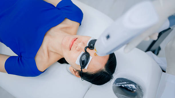 Acne Laser Scar Reduction in Bangalore – 2025