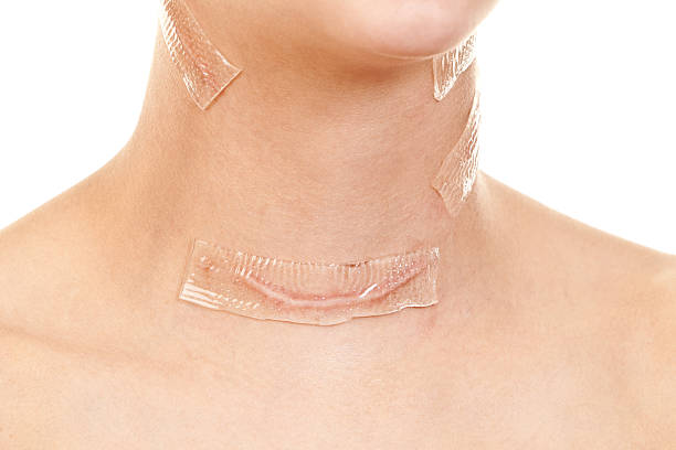 Scar Revision Surgery in Bangalore – 2025