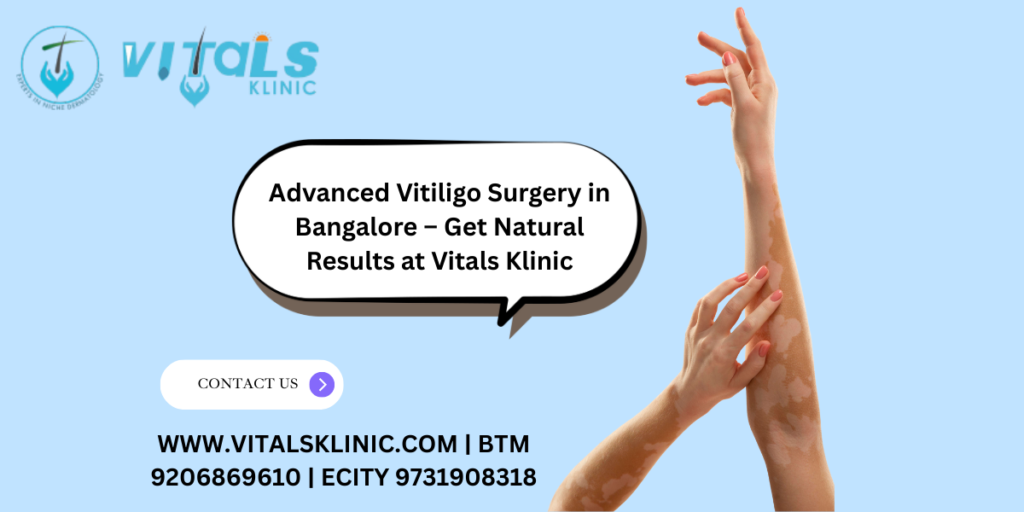 Vitiligo Treatment in Bangalore – 2026