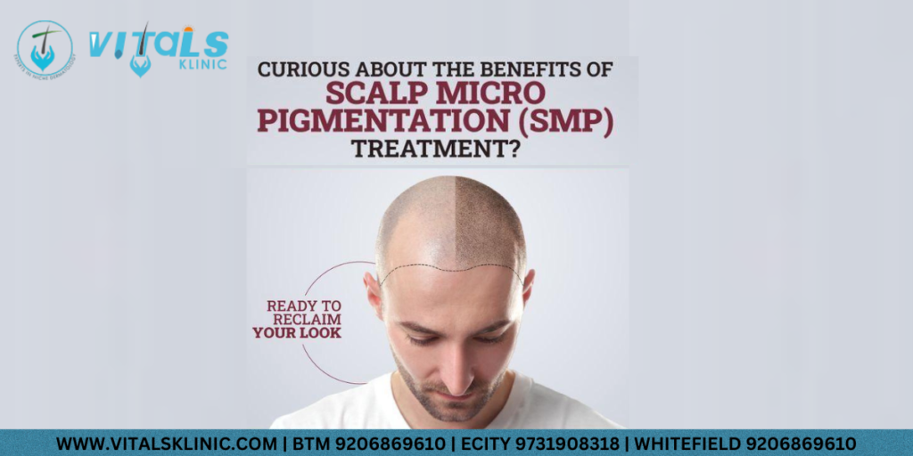 Scalp Micro Pigmentation in Bangalore – 2026